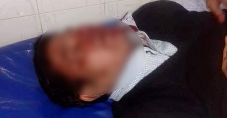 হামলায় মাথা ফাটল মঈন খানের সহকারীর