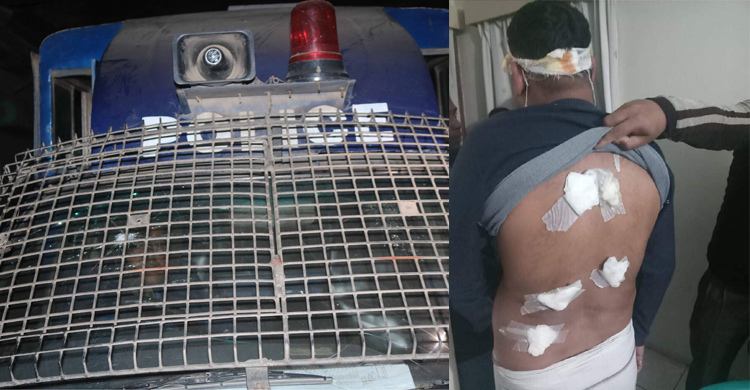 সিরাজগঞ্জে পুলিশ-বিএনপি সংঘর্ষ, প্রার্থীসহ আহত ২০