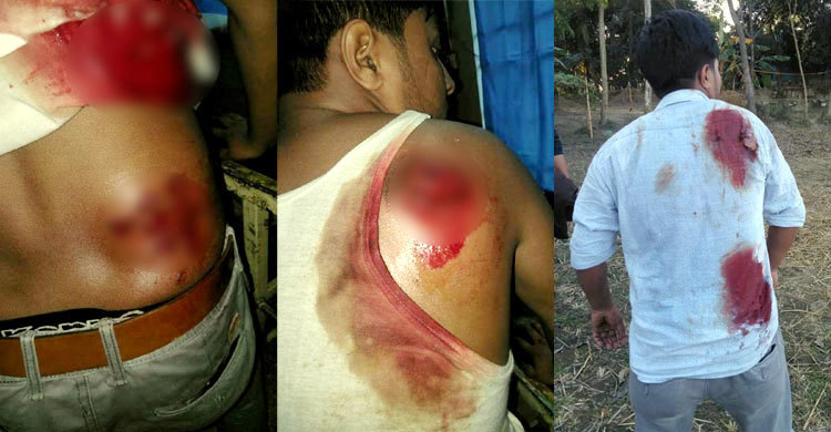 বিএনপির ৫০০ নেতাকর্মীর বিরুদ্ধে পুলিশের মামলা