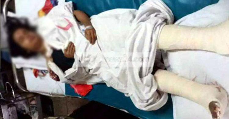 সাবেক স্ত্রীর পায়ের রগ কাটলেন স্বামী