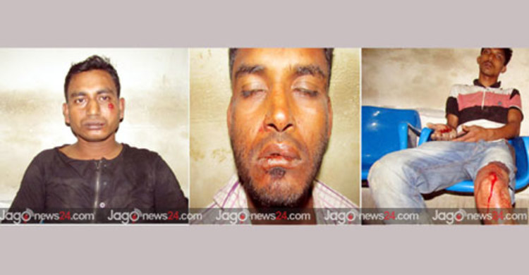 ঝালকাঠিতে সাংবাদিকের ওপর হামলার ঘটনায় মামলা