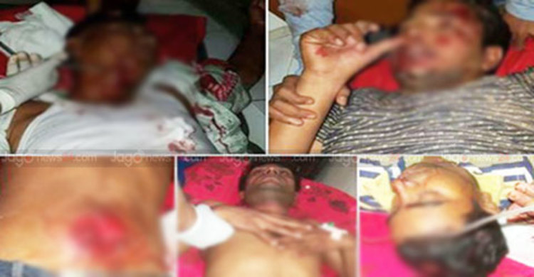 বেনাপোলে উপ-নির্বাচন ঘিরে সংঘর্ষ, আহত ১০