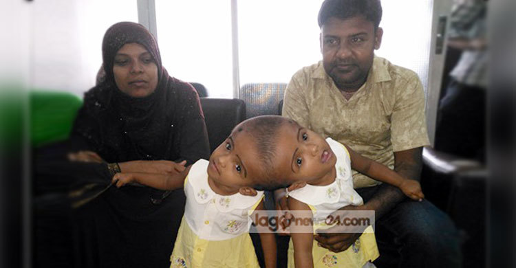 জ্ঞান ফিরেছে রাবেয়া-রুকাইয়ার : সক্রিয় বিকল্প রক্তনালী