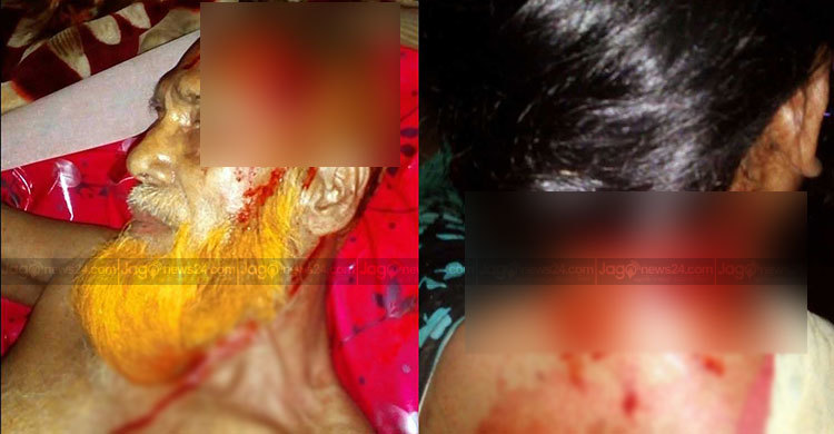 মঠবাড়িয়ায় মুক্তিযোদ্ধা পরিবারের ৩ জনকে কুপিয়ে জখম