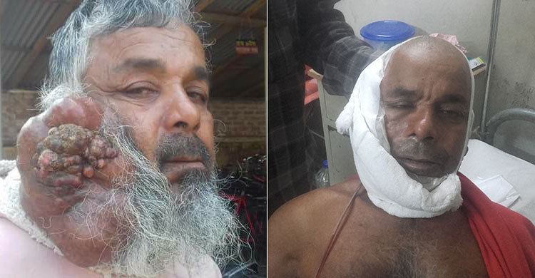 সাতক্ষীরার শহর আলীর সফল অস্ত্রোপচার