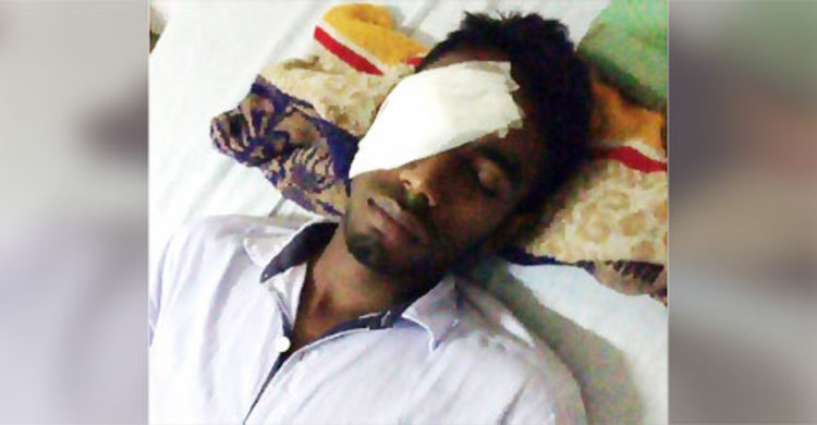 শিক্ষকের বেতের আঘাতে চোখ হারাতে বসেছে এসএসসি পরীক্ষার্থী