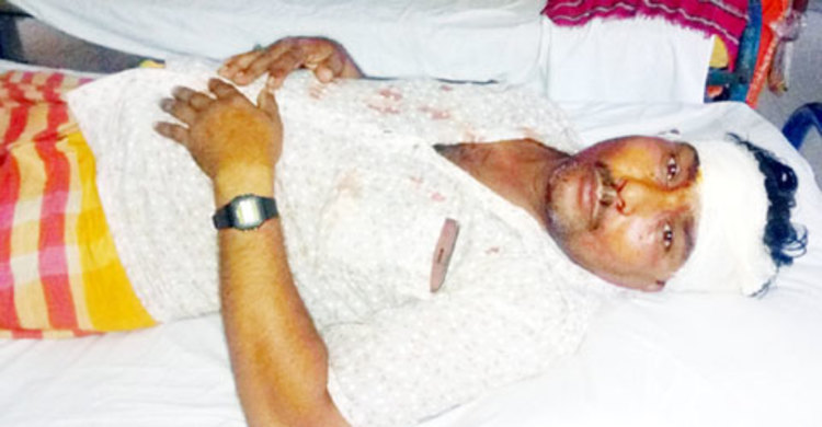 সাক্ষীকে কুপিয়ে জখম করল আসামিরা