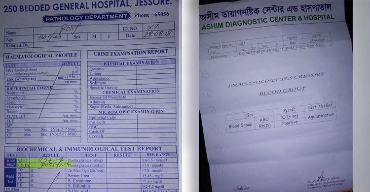 ‘বি পজেটিভ’ রক্ত হয়ে গেল ‘ও পজেটিভ’