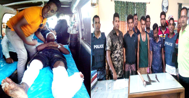 শিক্ষকের পা কেটে দিলো সন্ত্রাসীরা