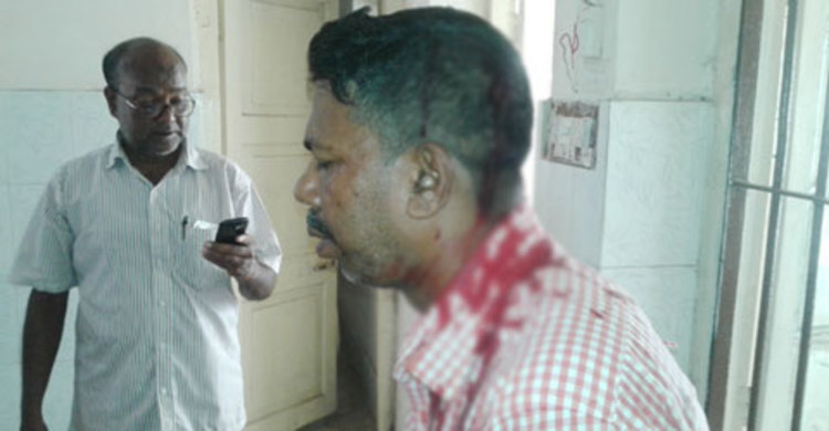 বালু উত্তোলনের ছবি তোলায় সাংবাদিক রক্তাক্ত