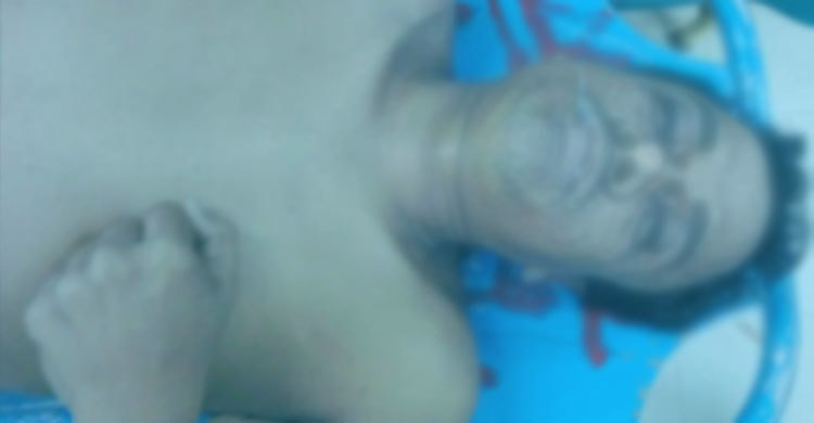 হোটেল থেকে আইওএম কর্মকর্তার মরদেহ উদ্ধার