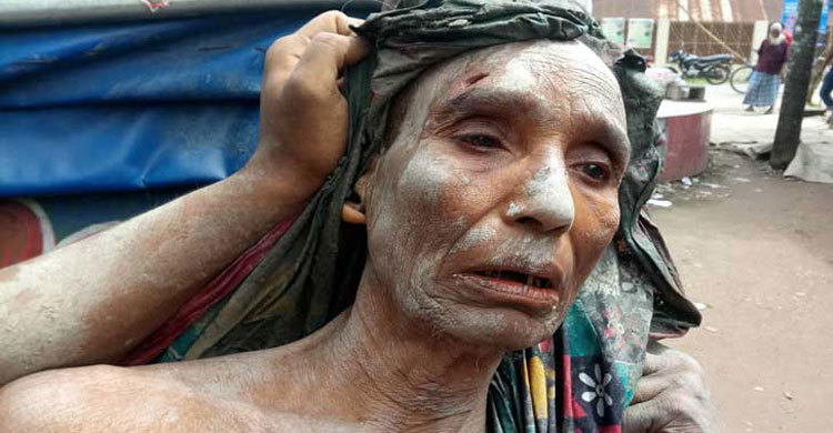 ভরণপোষণ চাওয়ায় মায়ের মাথা ফাটিয়ে দিলো ছেলে-পুত্রবধূ