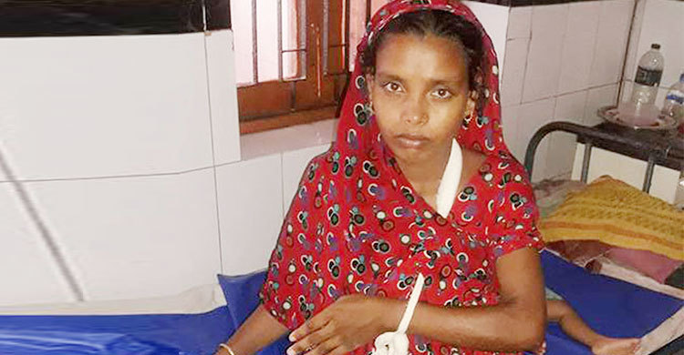 যৌতুকের দাবিতে স্ত্রীর হাত ভেঙে দিলো স্বামী