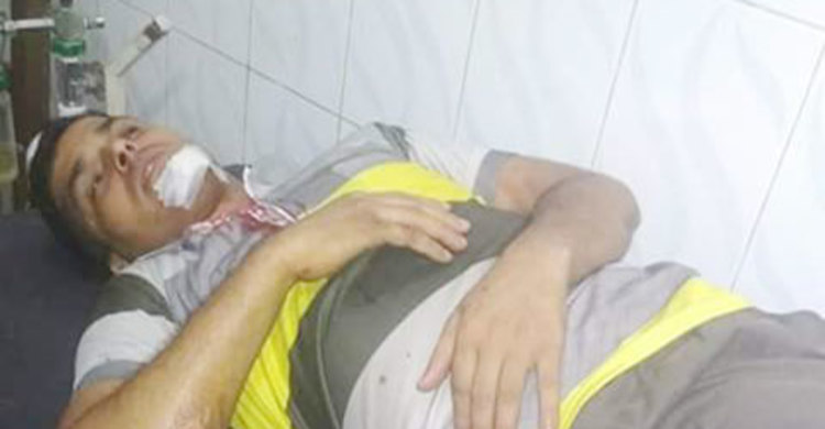 শ্রীপুরে ব্যবসায়ীকে কুপিয়ে টাকা ছিনতাই