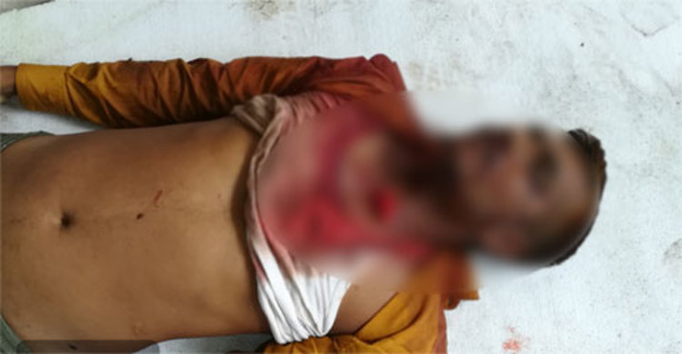 ভাড়া নিয়ে সংঘর্ষে সিএনজিচালক নিহত