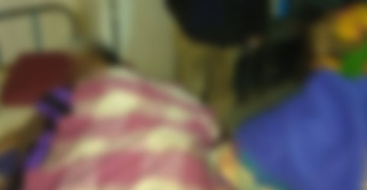 এসিডে ঝলসে গেছে দুই বোন