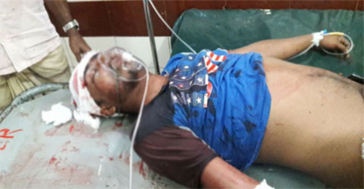 থানায় নির্যাতনের অভিযোগ, ছাদ থেকে লাফিয়ে পড়লেন নৈশপ্রহরী