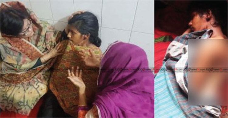 জ্বলন্ত চুলায় স্ত্রীর মুখ চেপে ধরলেন স্বামী