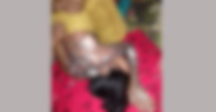 মৃত্যুর সঙ্গে পাঞ্জা লড়ছেন দগ্ধ ফাতেমা