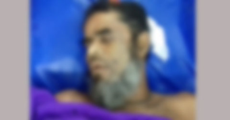 ভাতিজার হাতুড়ির আঘাতে চাচা নিহত