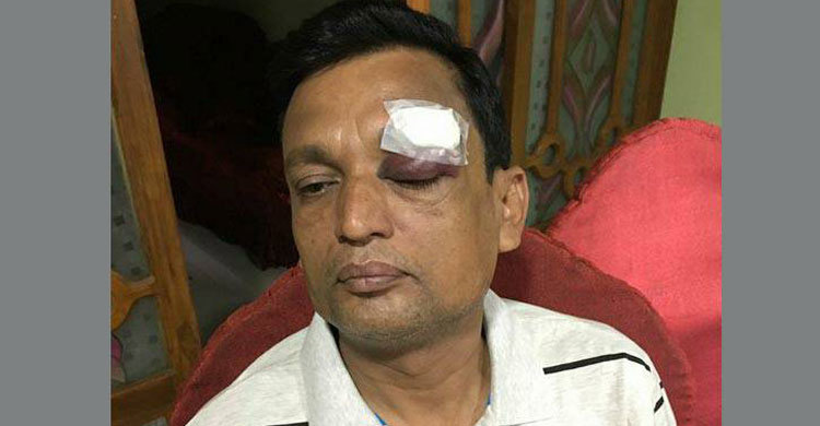 ট্রেনে ছোড়া পাথরে আ. লীগ নেতা আহত