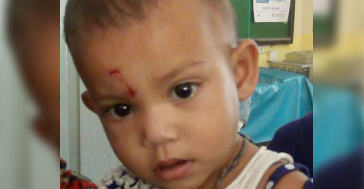 পাগলা কুকুরের কামড়ে আহত শতাধিক