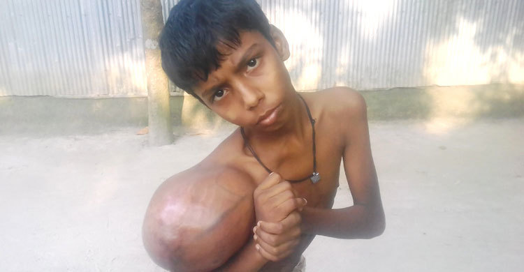 হোমিও খেয়ে দিন কাটছে জাকিরের