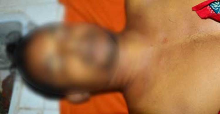 প্রতিপক্ষের হামলায় আহত যুবকের মৃত্যু