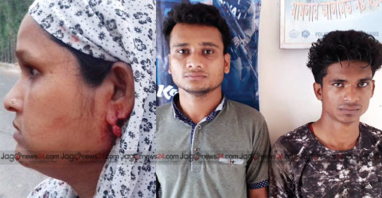 দুলের সঙ্গে কান ছিঁড়ে নিল ছিনতাইকারী