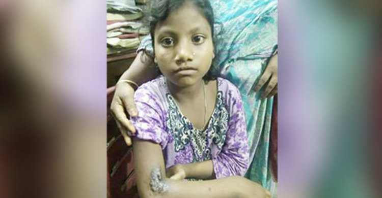 গরম খুন্তি দিয়ে গৃহকর্মীকে ছ্যাঁকার অভিযোগ