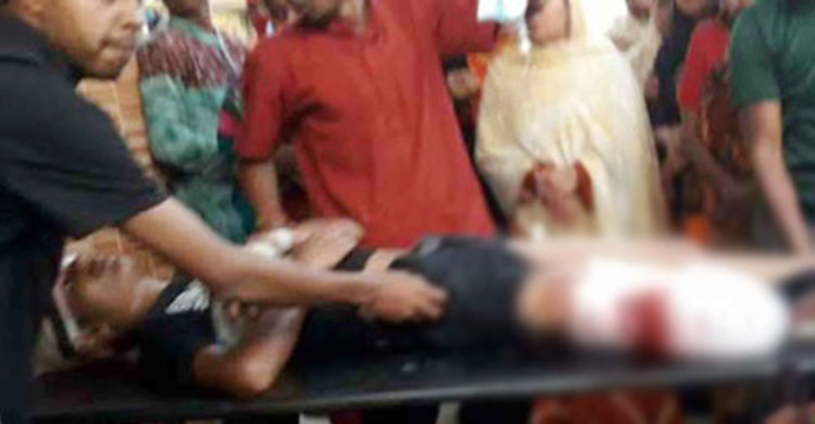 পা হারানো নিলয়কেও বাঁচানো গেলো না