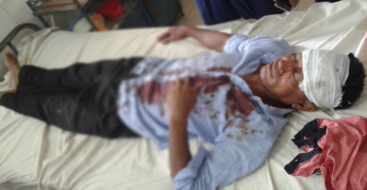 পটুয়াখালীতে ব্যবসায়ীকে কুপিয়ে ২০ লাখ টাকা ছিনতাই