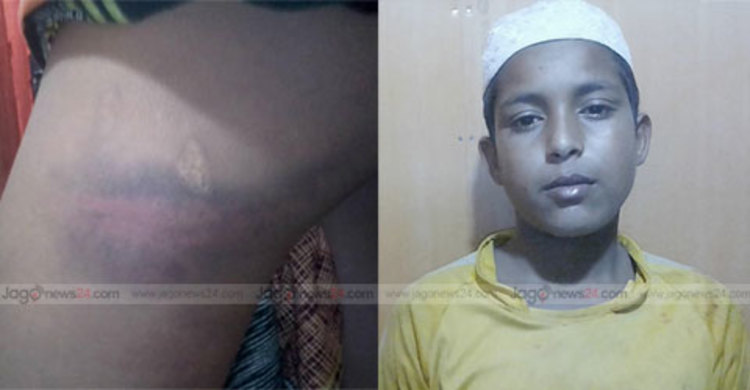 দুই শিশু শিক্ষার্থীকে ঝুলিয়ে পেটালেন শিক্ষক