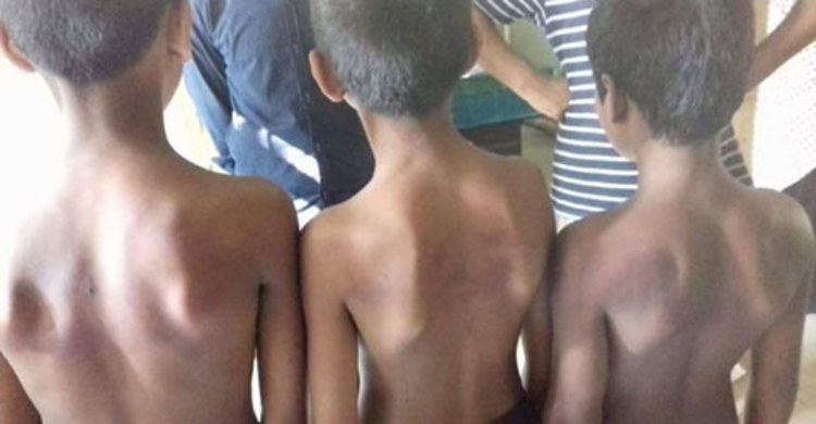 ৩ শিক্ষার্থীকে মেরে আহত করলেন শিক্ষক