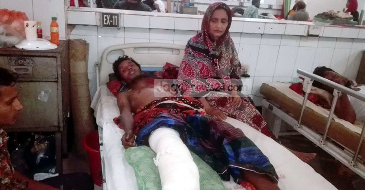 তৃষ্ণার্ত নারীর পানি আনতে গিয়ে পা হারান রাসেল