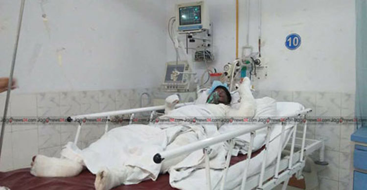 3 burnt, 4 injured in Ashulia gas blast