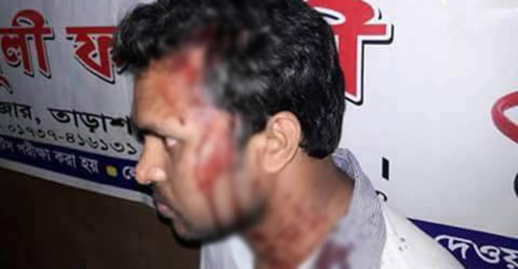 আ.লীগের সমর্থক হওয়ায় তাড়াশে বিসিএস ক্যাডারকে মারধর