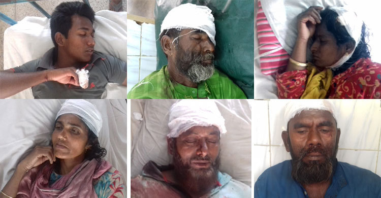 পাবনায় ধান কাটা নিয়ে দু’পক্ষের সংঘর্ষে আহত ১৫