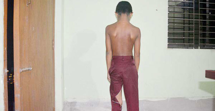 শিক্ষকের নির্যাতনে দিগম্বর চতুর্থ শ্রেণির ছাত্র