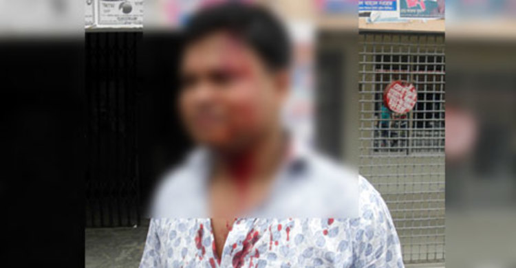 ভুয়া এতিমের বিল না দেয়ায় সমাজ সেবা কর্মকর্তাকে রক্তাক্ত
