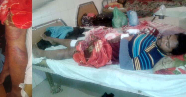 যুবদল নেতার রগ কাটার অভিযোগ