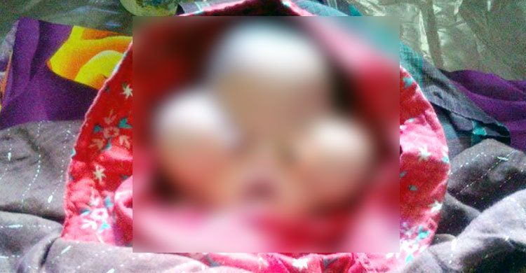 ভাণ্ডারিয়ায় বিরল আকৃতির শিশুর জন্ম