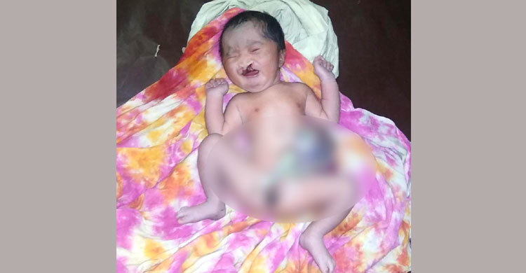 শিশুটি নিয়ে বিপাকে বাবা-মা