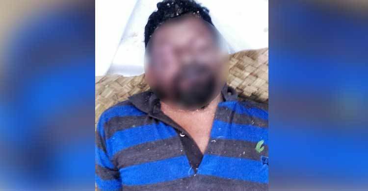 ২ মাসেও মেলেনি লাশের পরিচয়