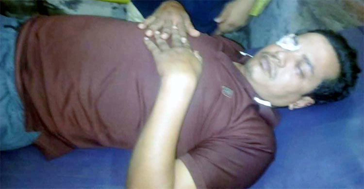 মোটরসাইকেলে ধাক্কা দেয়ায় অটোচালকের চোখ উৎপাটনের চেষ্টা