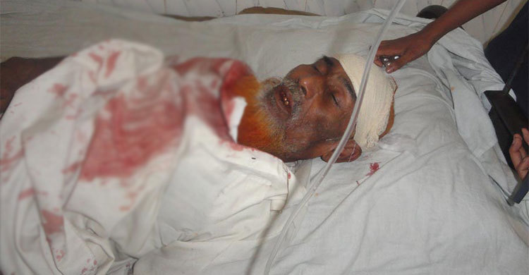 বৃদ্ধ বাবাকে হাতুড়িপেটা করল ওলামা লীগ নেতা