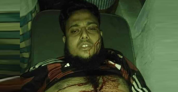 সাতক্ষীরায় যুবলীগ নেতাকে হাতুড়িপেটা