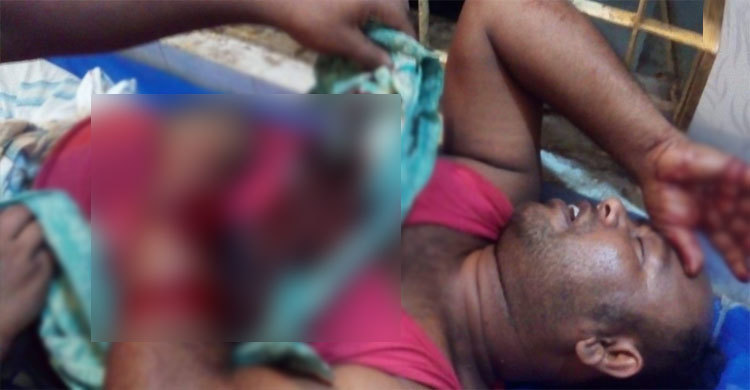 বড় ভাইকে রক্তাক্ত করল ছোট ভাই