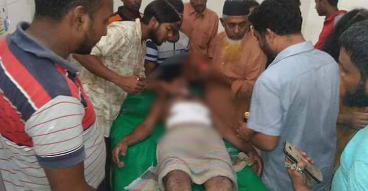 বাউফলে চা বিক্রেতাকে কুপিয়ে জখম