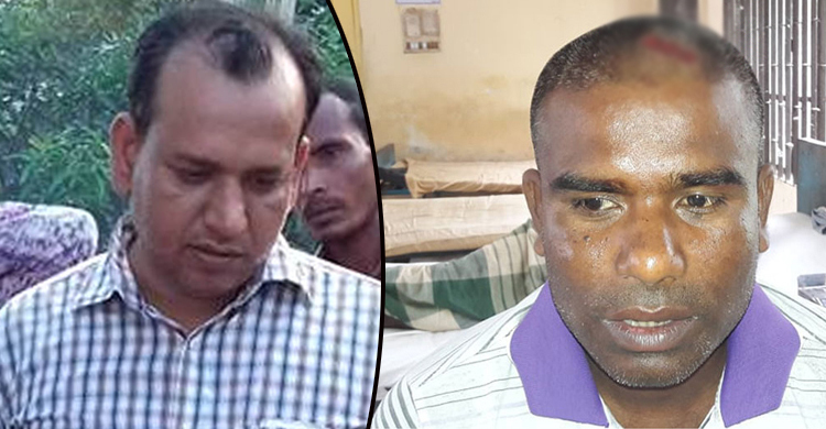 সেই সার্ভেয়ারের বিরুদ্ধে মামলা, ইউএনও’র শোকজ
